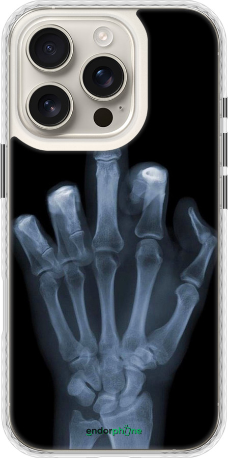 Чохол Bumper чехол Рука через рентген для Apple iPhone 16 Pro - 1007pc-3708 изображение 