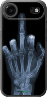 Силиконовый чехол Рука через рентген для Apple iPhone 17 AIR - 1007u-4032 изображение 
