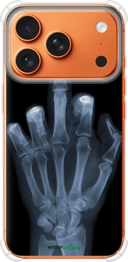 Силикон с усиленными углами чехол Рука через рентген для Apple iPhone 17 PRO MAX - 1007sp-4029 изображение 