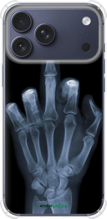 Силикон с усиленными углами чехол Рука через рентген для Apple iPhone 17 PRO - 1007sp-4030 изображение 