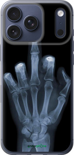 Силиконовый чехол Рука через рентген для Apple iPhone 17 PRO - 1007u-4030 изображение 