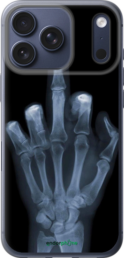 Силиконовый чехол Рука через рентген для Apple iPhone 17 PRO - 1007u-4030 изображение 