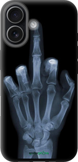 TPU чехол Рука через рентген для Apple iPhone 17 - 1007b-4031 изображение 