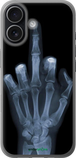 Силіконовий чехол Рука через рентген для Apple iPhone 17 - 1007u-4031 изображение 