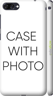 matte 3D plastic case case 'Photo case' for Asus ZenFone 4 Max ZC520KL image 1