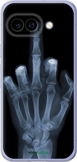 Силиконовый чехол Рука через рентген для Google Pixel 9A - 1007u-3899 изображение 