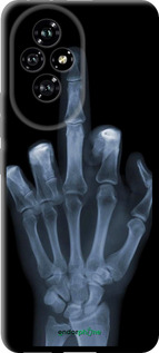 TPU чехол Рука через рентген для Huawei Honor 200 - 1007b-3731 изображение 