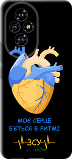 TPU чехол Сердце v2 для Huawei Honor 200 - 5296b-3731 изображение 