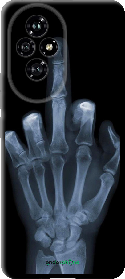 TPU чехол Рука через рентген для Huawei Honor 200 - 1007b-3731 изображение 