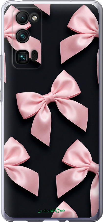 Силиконовый чехол Coquette Ribbons Dark Coquette для Huawei Honor 30 Pro - 6767u-1920 изображение 