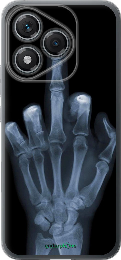 Силиконовый чехол Рука через рентген для Huawei Honor 400 Lite 5G - 1007u-3993 изображение 