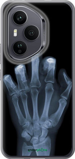 Силиконовый чехол Рука через рентген для Huawei Honor 400 PRO 5G - 1007u-4036 изображение 