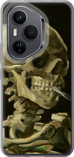 Силиконовый чехол Винсент Ван Гог. Череп для Huawei Honor 400 PRO 5G - 5544u-4036 изображение 