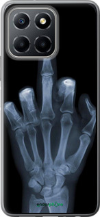 Силиконовый чехол Рука через рентген для Huawei Honor X8 5G - 1007u-4149 изображение 
