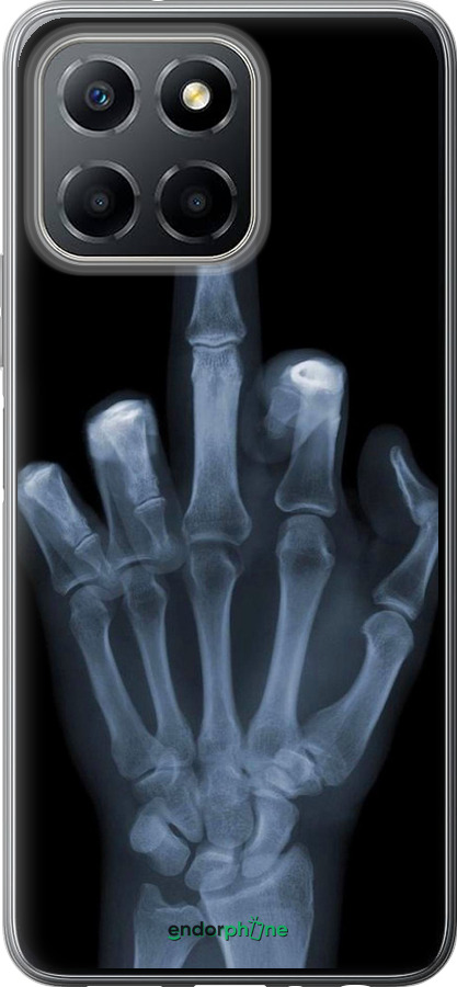 Силиконовый чехол Рука через рентген для Huawei Honor X8 5G - 1007u-4149 изображение 