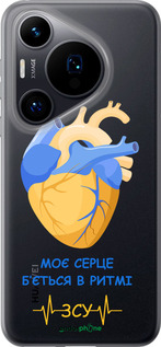 Силиконовый чехол Сердце v2 для Huawei Pura 70 - 5296u-3703 изображение 