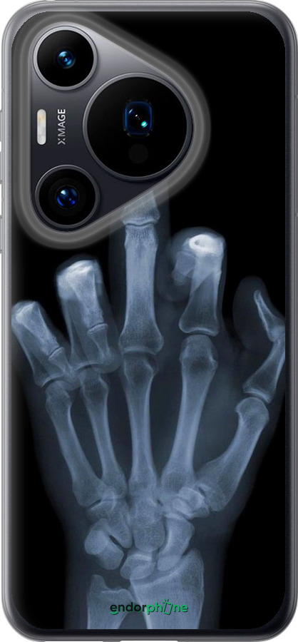 Силиконовый чехол Рука через рентген для Huawei Pura 70 - 1007u-3703 изображение 