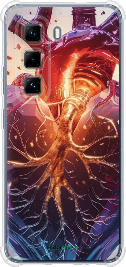 Силіконовий протиударний с посиленими кутами чехол Crystal Heart для Infinix Hot 50 Pro 4G - 6070sp-3871 изображение 