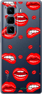 Силиконовый чехол Губы v3 для Infinix Hot 50 Pro+ 4G - 5477u-3870 изображение 