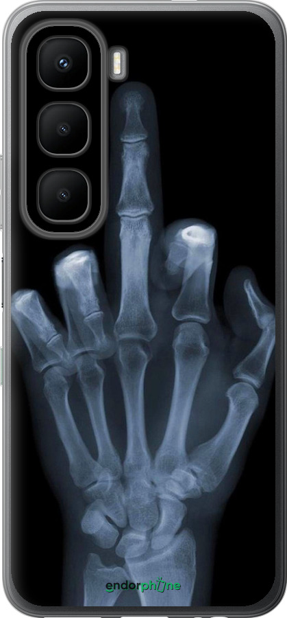 Силиконовый чехол Рука через рентген для Infinix Hot 60 5G / Hot 60i 4G - 1007u-4114 изображение 