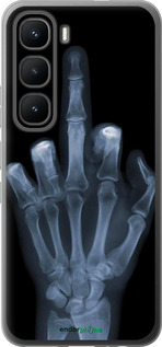 Силіконовий чехол Рука через рентген для Infinix Hot 60 Pro - 1007u-4126 изображение 