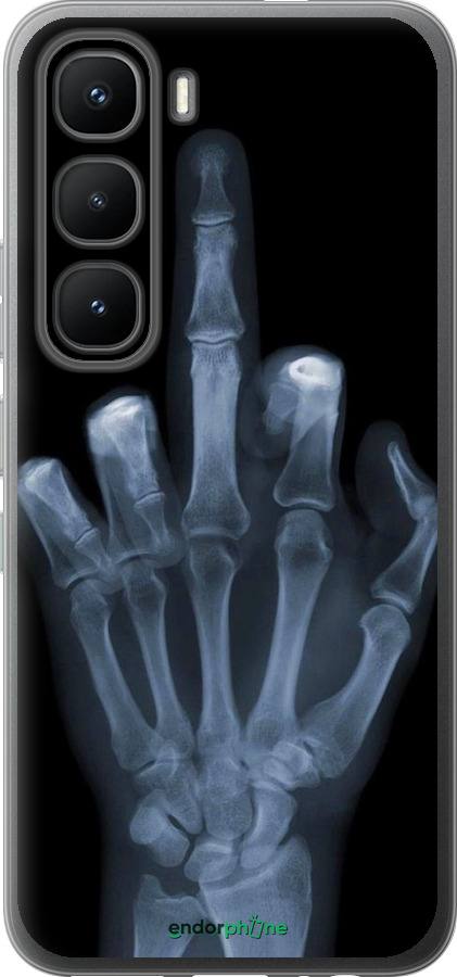 Силіконовий чехол Рука через рентген для Infinix Hot 60 Pro - 1007u-4126 изображение 