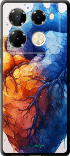 TPU чехол Арт-сердце для Infinix Note 40 PRO 5G - 6034b-3690 изображение 