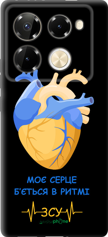 TPU чехол Сердце v2 для Infinix Note 40 PRO 5G - 5296b-3690 изображение 