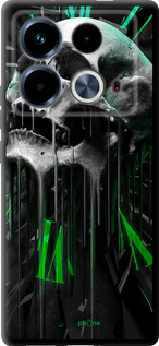 TPU чехол Череп-часы для Infinix Note 40 - 4100b-3707 изображение 