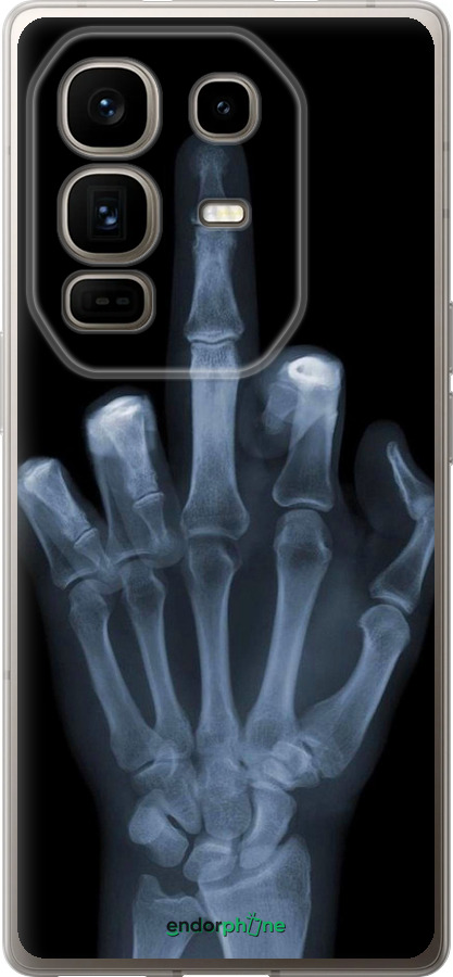 Силіконовий чехол Рука через рентген для Infinix Note 50 Pro+ - 1007u-4041 изображение 