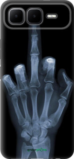 Силіконовий чехол Рука через рентген для Infinix Smart 10 PLus - 1007u-4108 изображение 