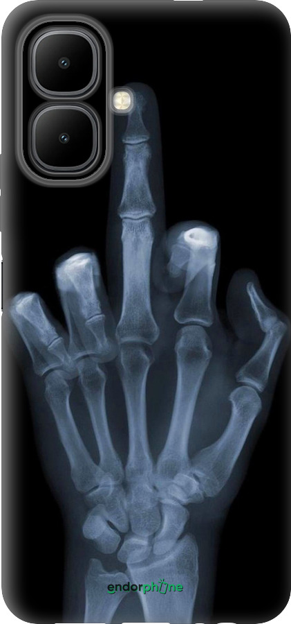 Силиконовый чехол Рука через рентген для Infinix Smart 10 - 1007u-4104 изображение 