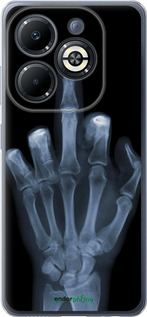 Силиконовый чехол Рука через рентген для Infinix Smart 8 Plus - 1007u-3677 изображение 