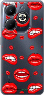 Силіконовий чехол Губи v3 для Infinix Smart 8 Plus - 5477u-3677 изображение 