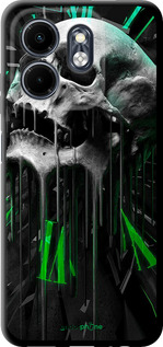 TPU чехол Череп-часы для Infinix Smart 9 - 4100b-3809 изображение 