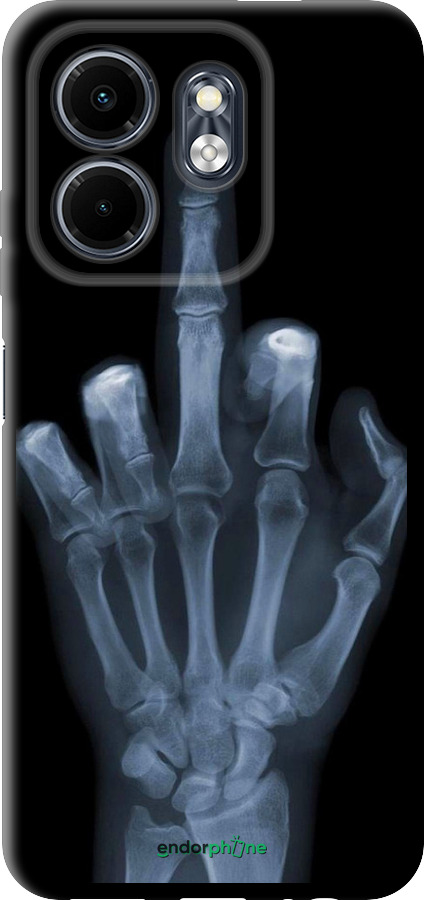 TPU чехол Рука через рентген для Infinix Smart 9 - 1007b-3809 изображение 