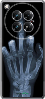 Силиконовый чехол Рука через рентген для Infinix Zero 40 5G - 1007u-3822 изображение 
