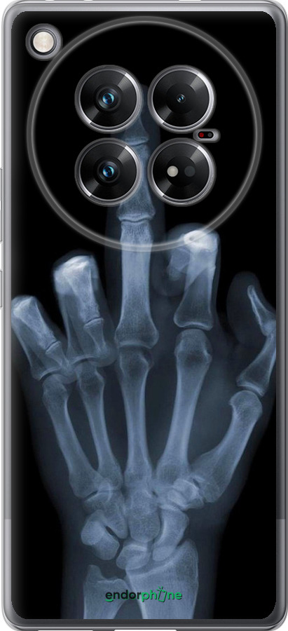 Силиконовый чехол Рука через рентген для Infinix Zero 40 5G - 1007u-3822 изображение 