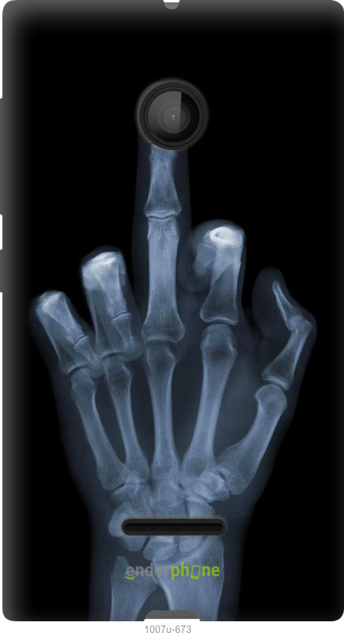 Силіконовий чехол Рука через рентген для Microsoft Lumia 435 - 1007u-673 изображение 