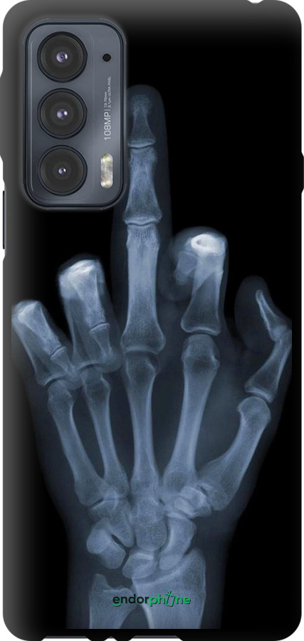 TPU чехол Рука через рентген для Motorola Edge 20 - 1007b-2497 изображение 