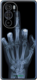 Силиконовый чехол Рука через рентген для Motorola Edge 30 Pro - 1007u-2826 изображение 