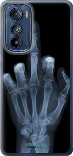 Силіконовий чехол Рука через рентген для Motorola Edge 30 - 1007u-2840 изображение 