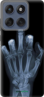 Силиконовый чехол Рука через рентген для Motorola Edge 60 Fusion 5G - 1007u-4021 изображение 