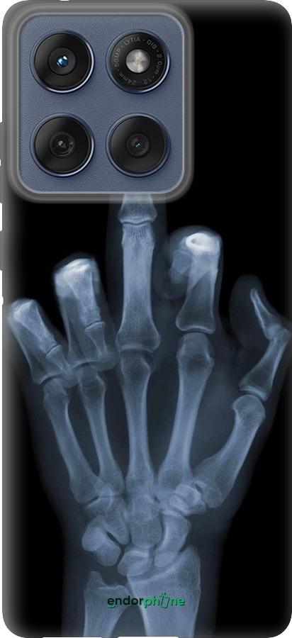 Силиконовый чехол Рука через рентген для Motorola Edge 60 Fusion 5G - 1007u-4021 изображение 