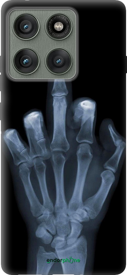 Силиконовый чехол Рука через рентген для Motorola Edge 60 Pro 5G - 1007u-4020 изображение 