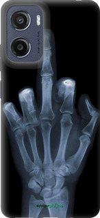 Силіконовий чехол Рука через рентген для Motorola Moto G05 - 1007u-3949 изображение 
