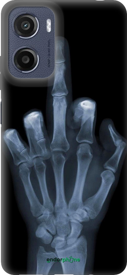 Силіконовий чехол Рука через рентген для Motorola Moto G05 - 1007u-3949 изображение 