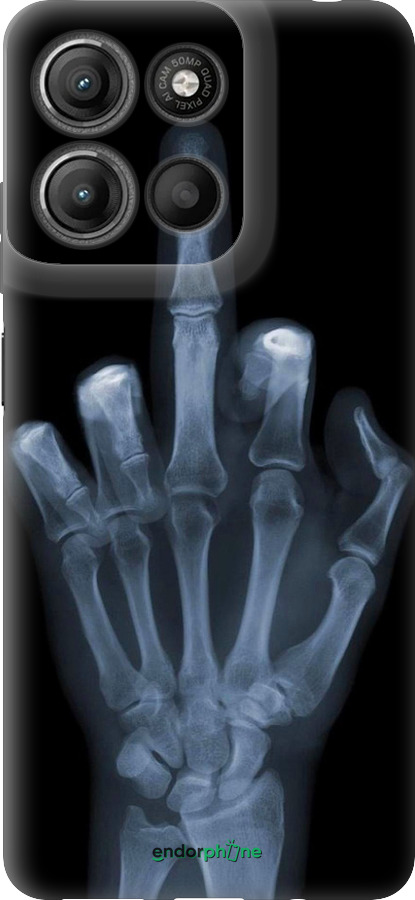 Силіконовий чехол Рука через рентген для Motorola Moto G15 Power - 1007u-4044 изображение 