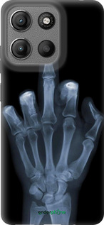 Силиконовый чехол Рука через рентген для Motorola Moto G15 - 1007u-3948 изображение 