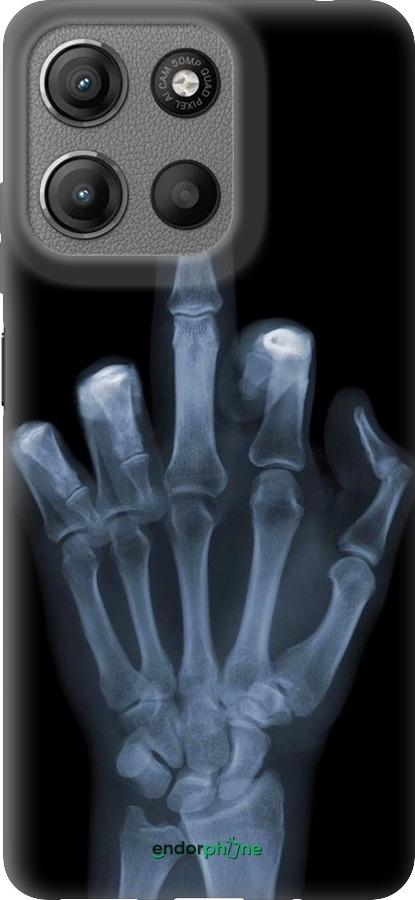 Силиконовый чехол Рука через рентген для Motorola Moto G15 - 1007u-3948 изображение 